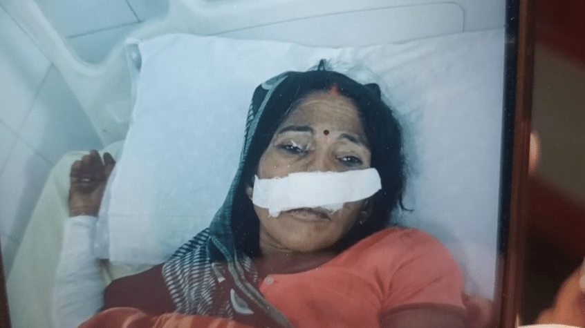 Bahraich: Four people, including a woman, injured in a jackal attack.