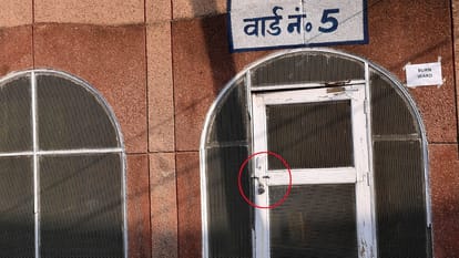 बर्न वार्ड पर लटका ताला