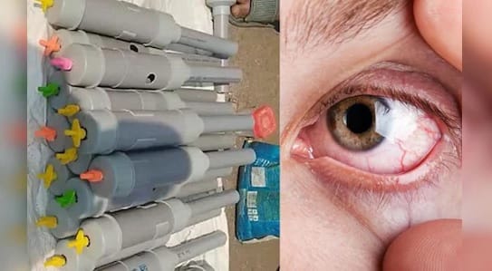 Kanpur Carbide firecrackers have robbed 12 patients of their sight in one eye preventing wounds from healing