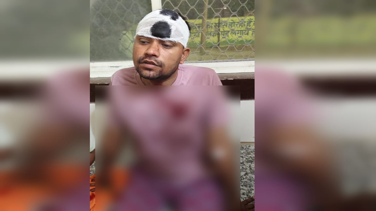 Pratapgarh Crime News A young man sitting in front of his house was shot and referred to the district hospital