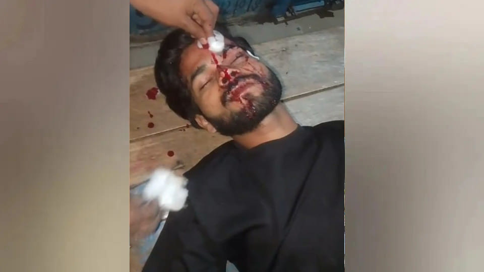 A rowdy youth attacked two brothers with a knife in Deoria, injuring both brothers.