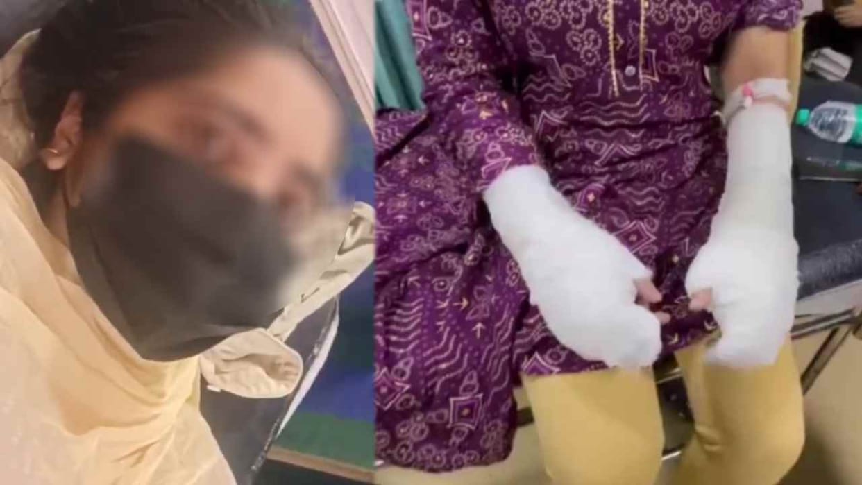 Delhi acid attack case accused wife has leveled serious allegations against victim father
