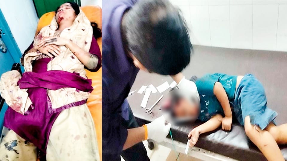 Meerut: Mother Risks Life to Save Daughter from Train, Both Injured in Doarala Incident