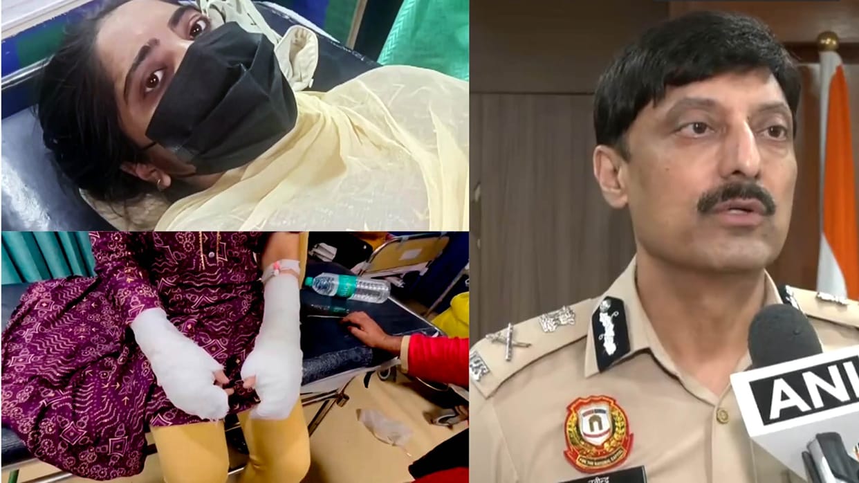 Delhi acid attack case Student father writes script student left home with mild acid and a kurti