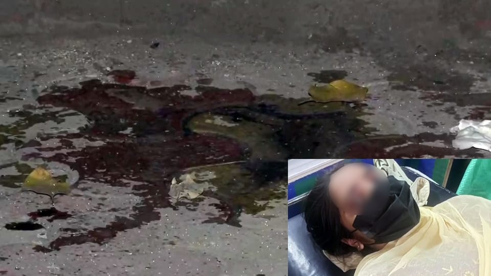 Student fabricates acid attack story to save father in delhi
