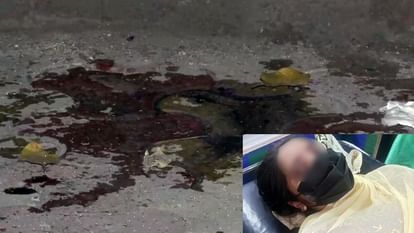 Acid Attack: बाप की साजिश... बेटी ने खुद पर छिड़का तेजाब? एसिड अटैक की कहानी में इन सवालों से आया नया ट्विस्ट Student fabricates acid attack story to save father in delhi