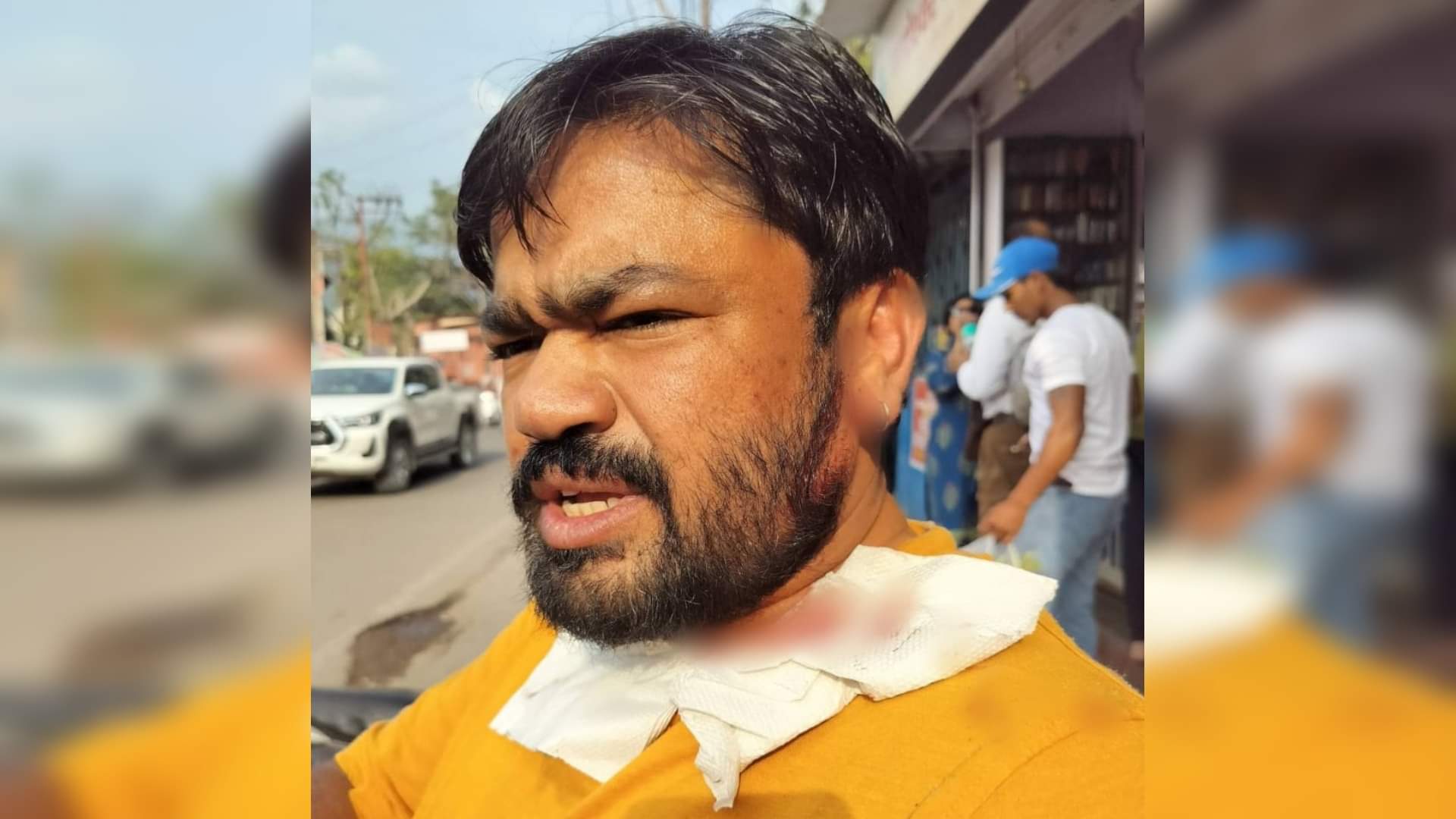 घायल विष्णु गुप्ता