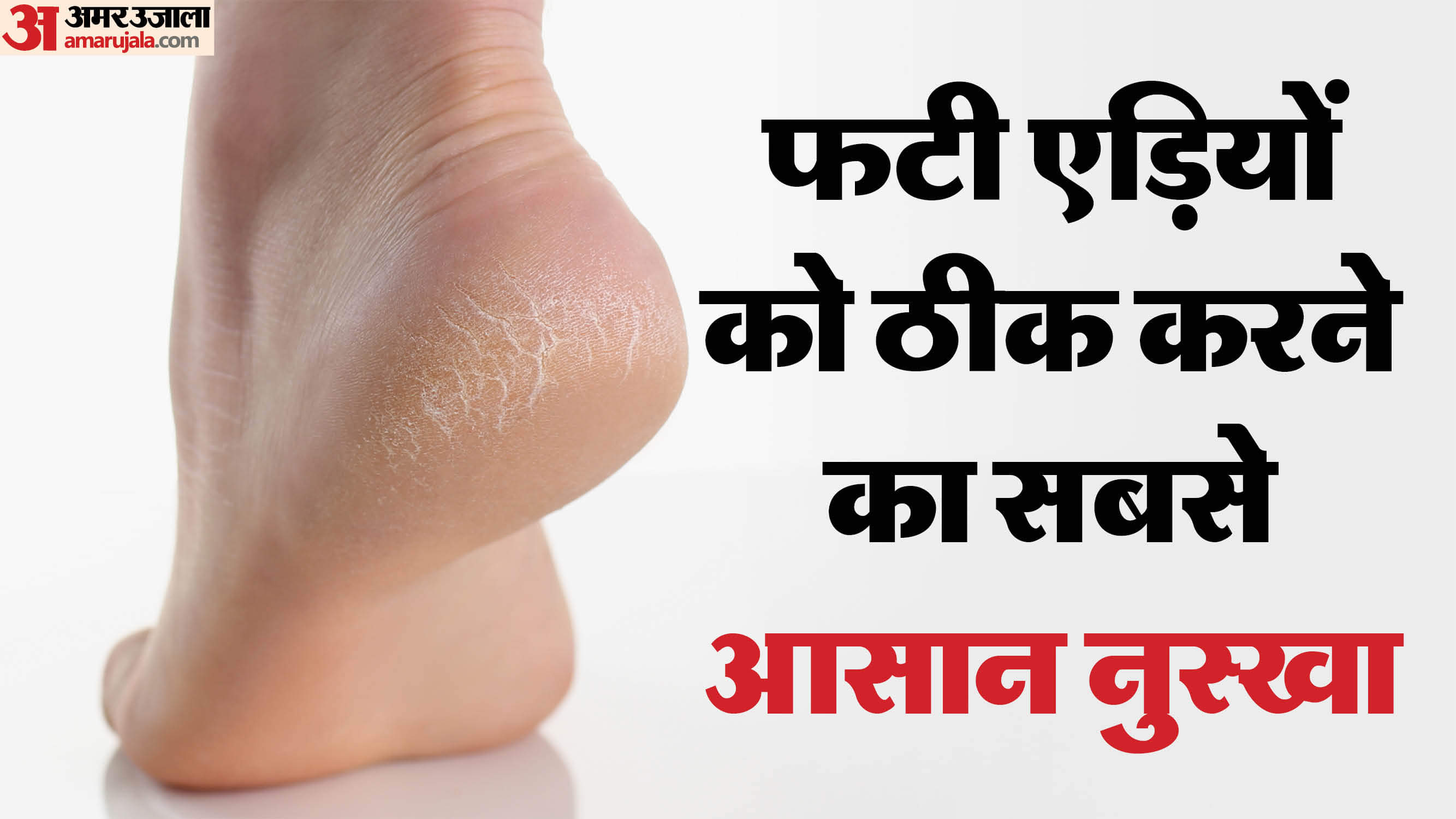 फटी एड़ियों को सही करने के लिए अब नहीं है महंगी क्रीम की जरूरत