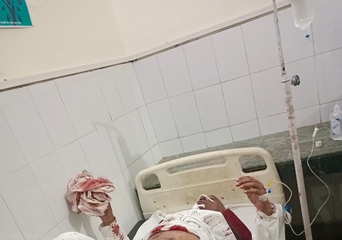 Congress Leader and His Brother Shot After Wedding Function in Agra