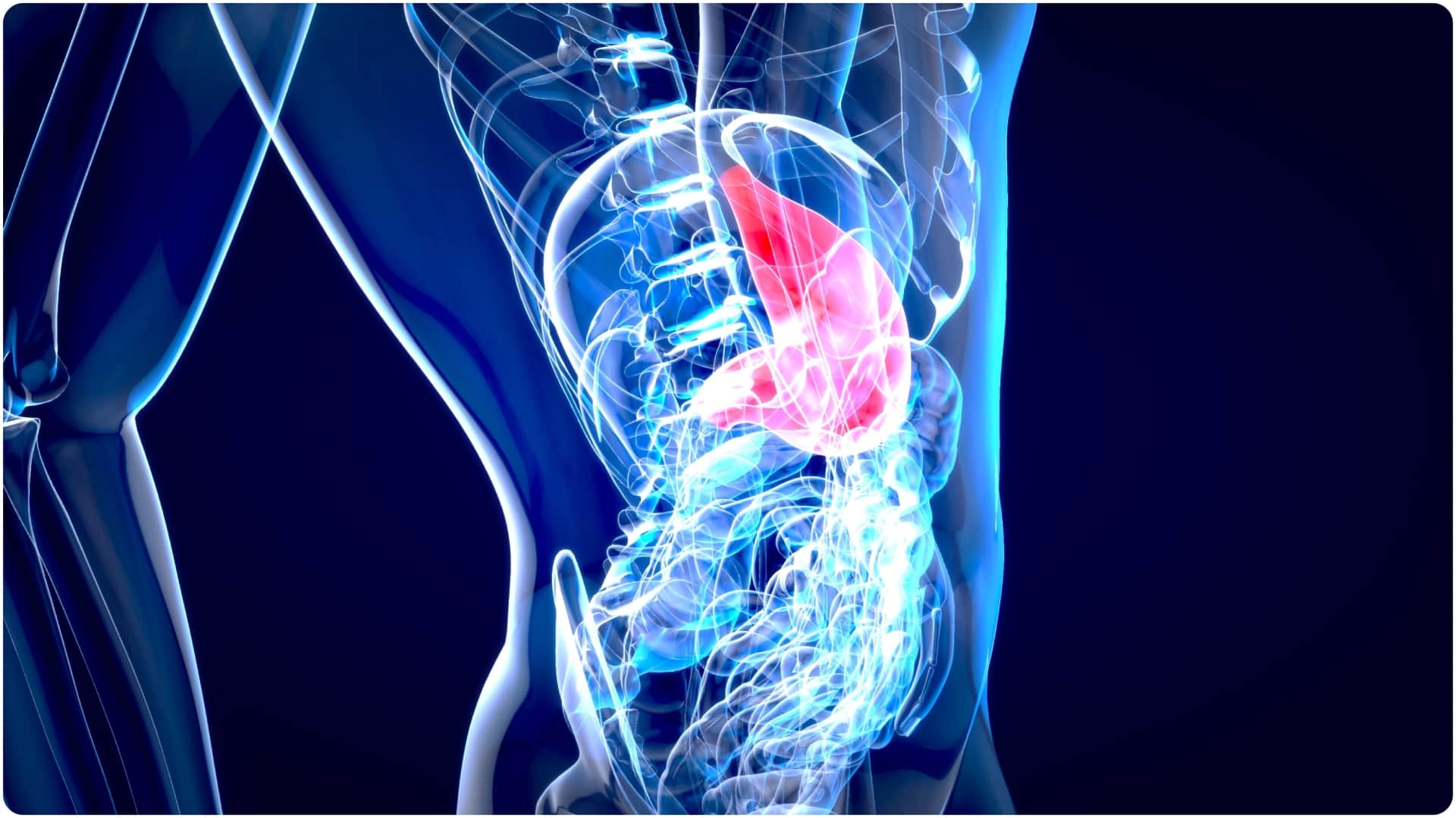 Gastrointestinal Stromal Tumor GIST cancer risk factors and details know its causes in hindi