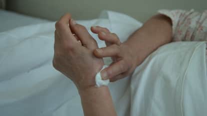 Leprosy Eradication Day: disease not spread by touch, treatment is possible