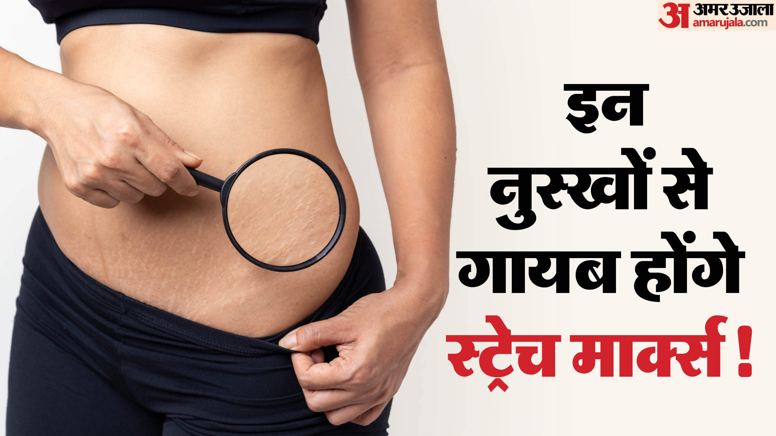 स्ट्रेच मार्क्स हटाने में काम आएंगे ये नुस्खे