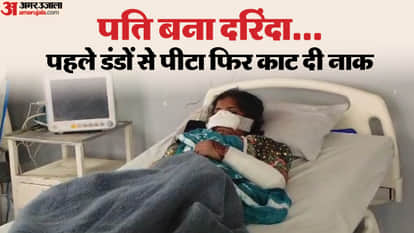 Shocking incident: Husband cuts off wife's nose after a dispute in Jhabua