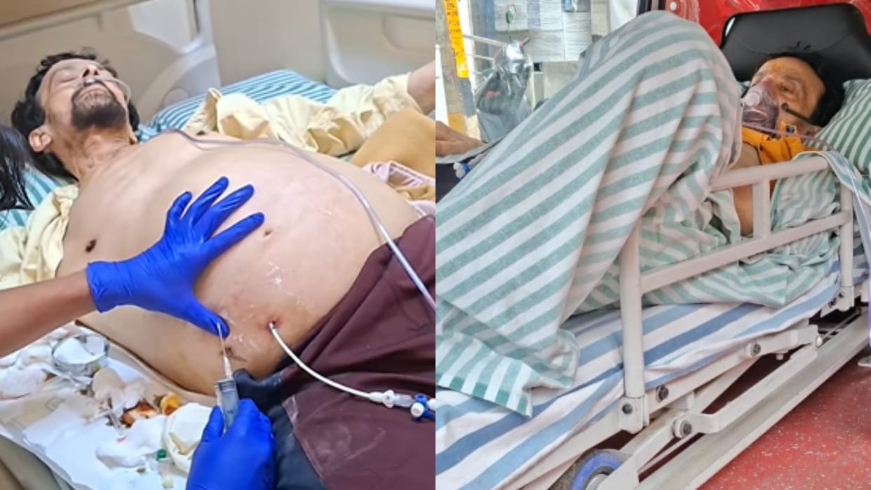 harish rai last video goes viral kannada actor died due to cancer kgf actor