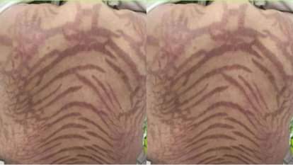 Woman slept after applying cream woke up in the morning with a snake like body she was stunned to see