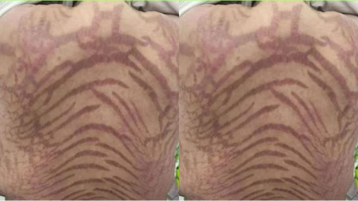 Woman slept after applying cream woke up in the morning with a snake like body she was stunned to see