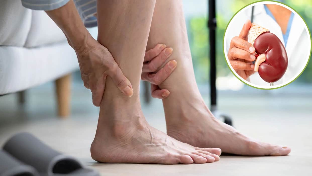 Health Tips: Leg Pain and Major Symptoms Could Indicate Kidney Failure Signs
