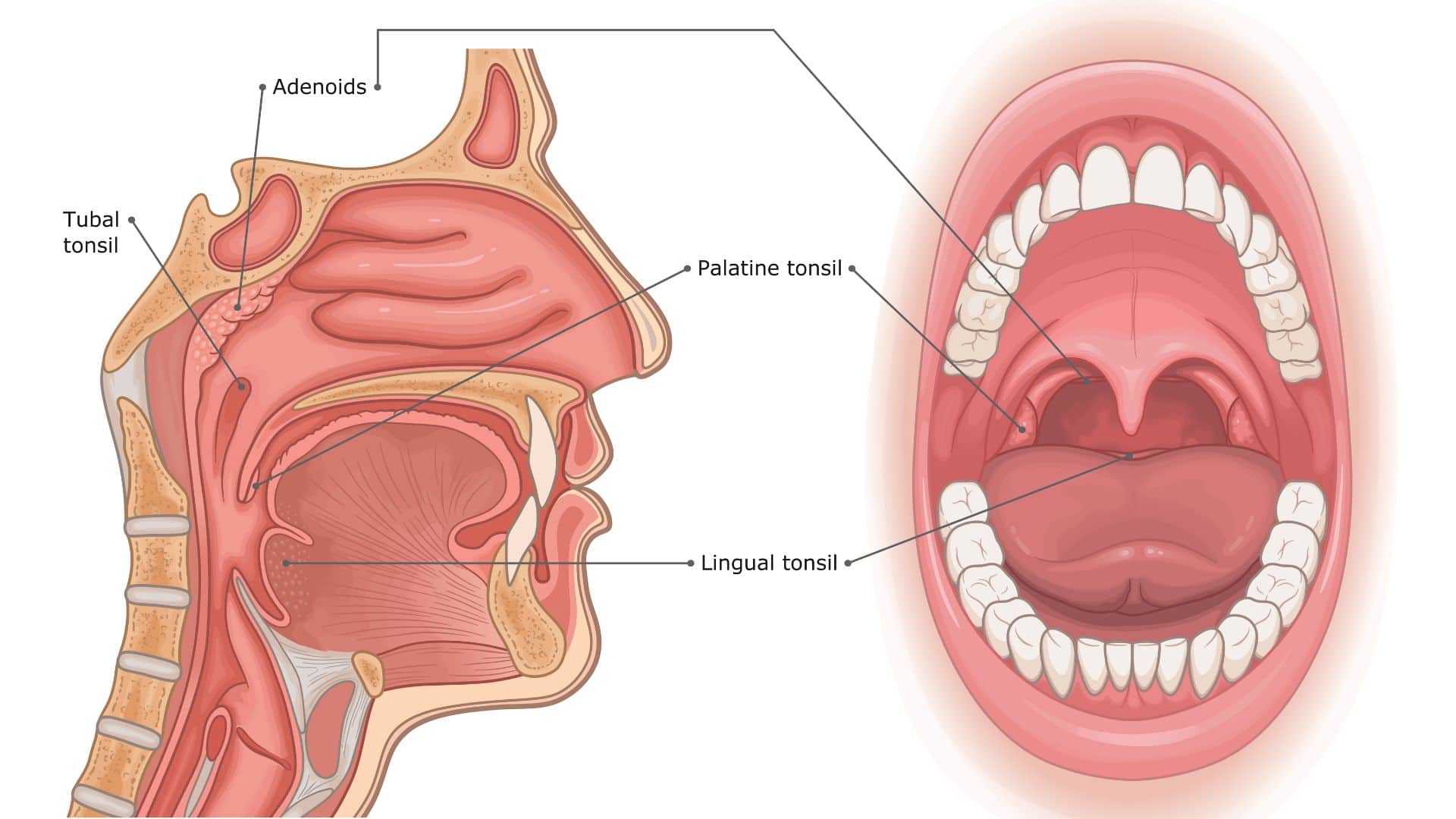 Home Remedies for Tonsillitis Swollen Throat Pain in Winter These Desi Cures Can Provide Immediate Relief