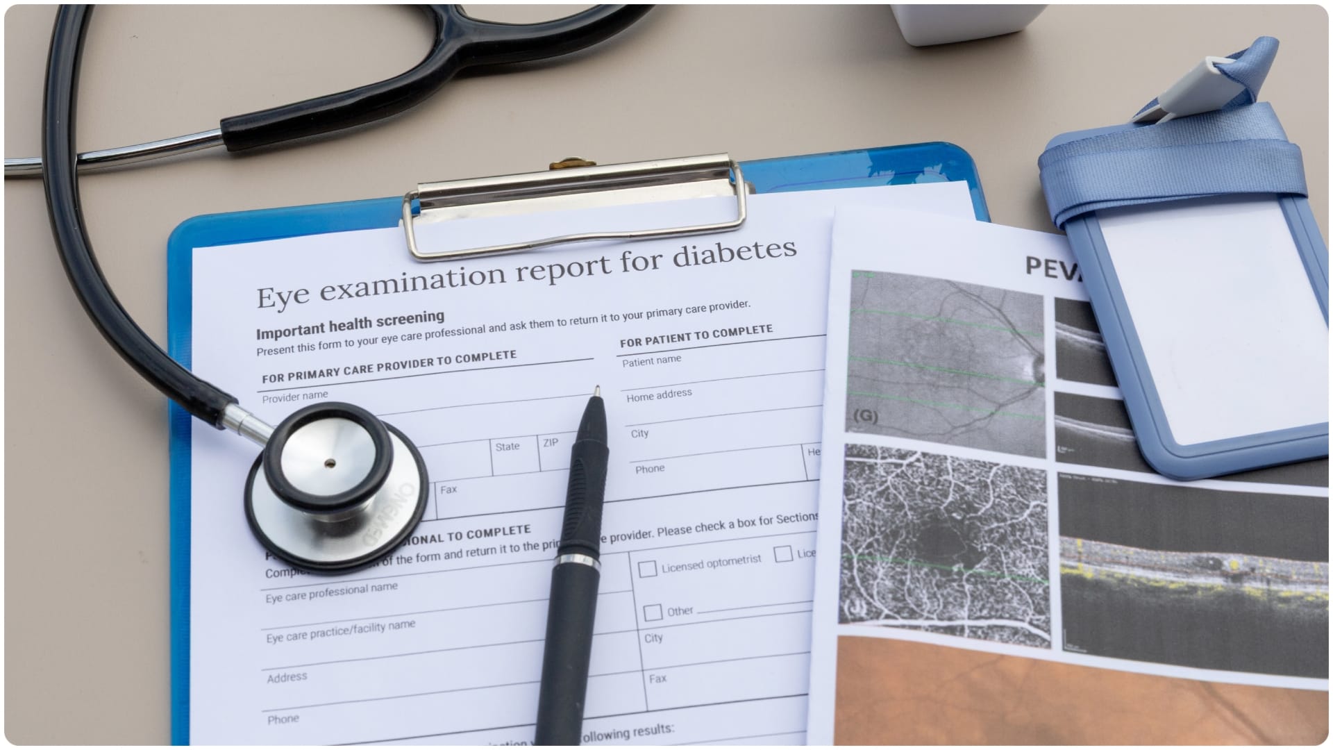 world diabetes day 2025 Diabetic retinopathy details know Signs of diabetes in the eyes