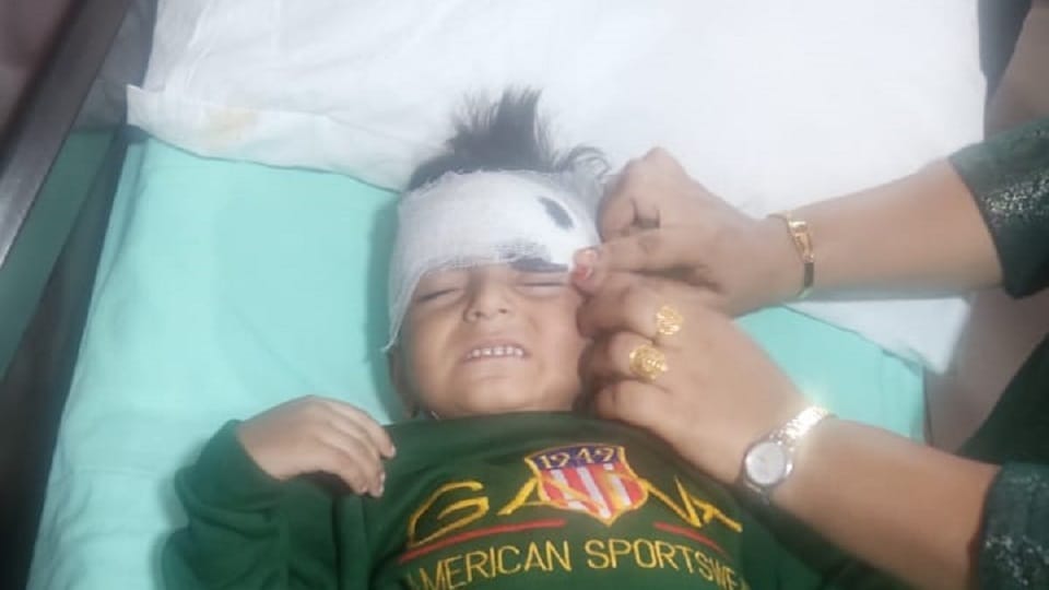 Child Injured at Taj Mahal: Delhi Tourist’s Son Falls on Stairs