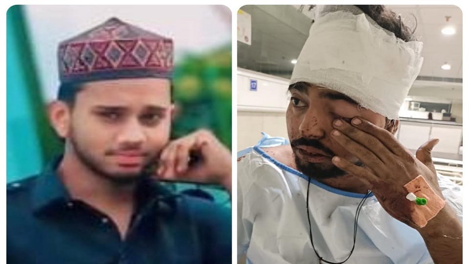 Delhi Blast: Noman dead, brother Aman on ventilator, uncle Mehboob expresses grief, said this