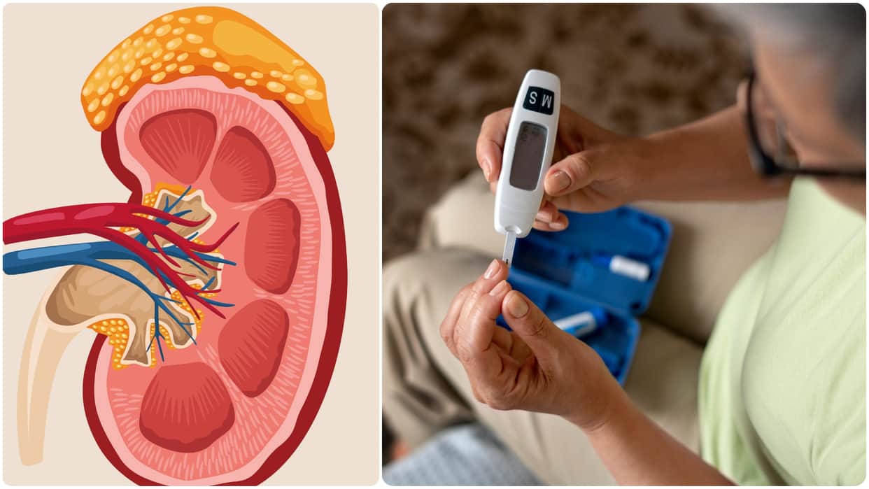 world diabetes day 2025 diabetes nephropathy know how diabetes affects kidney health