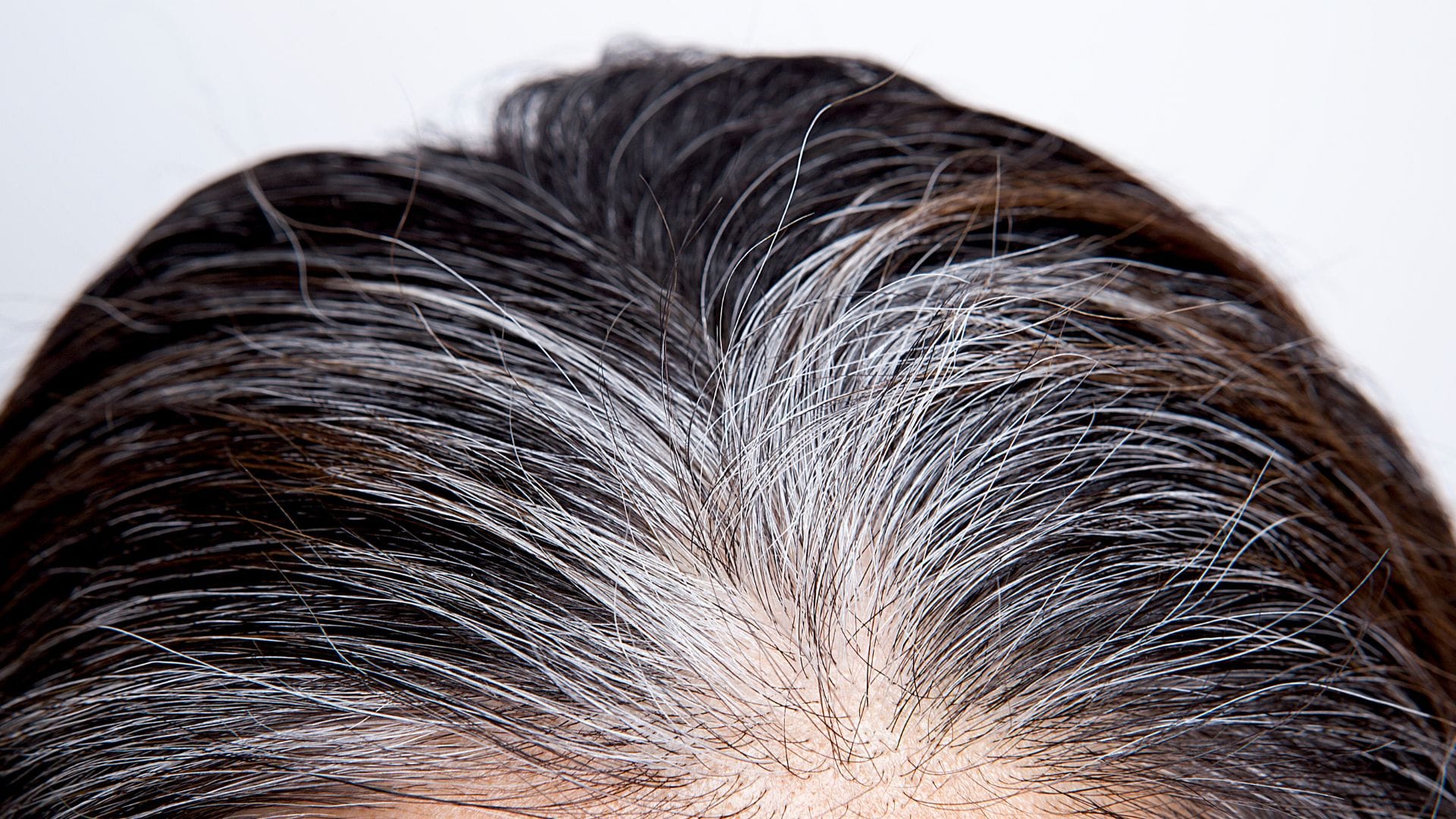 Health Tips: Premature Grey Hair At A Young Age Know Cause Safed Baal Hone ke Karan