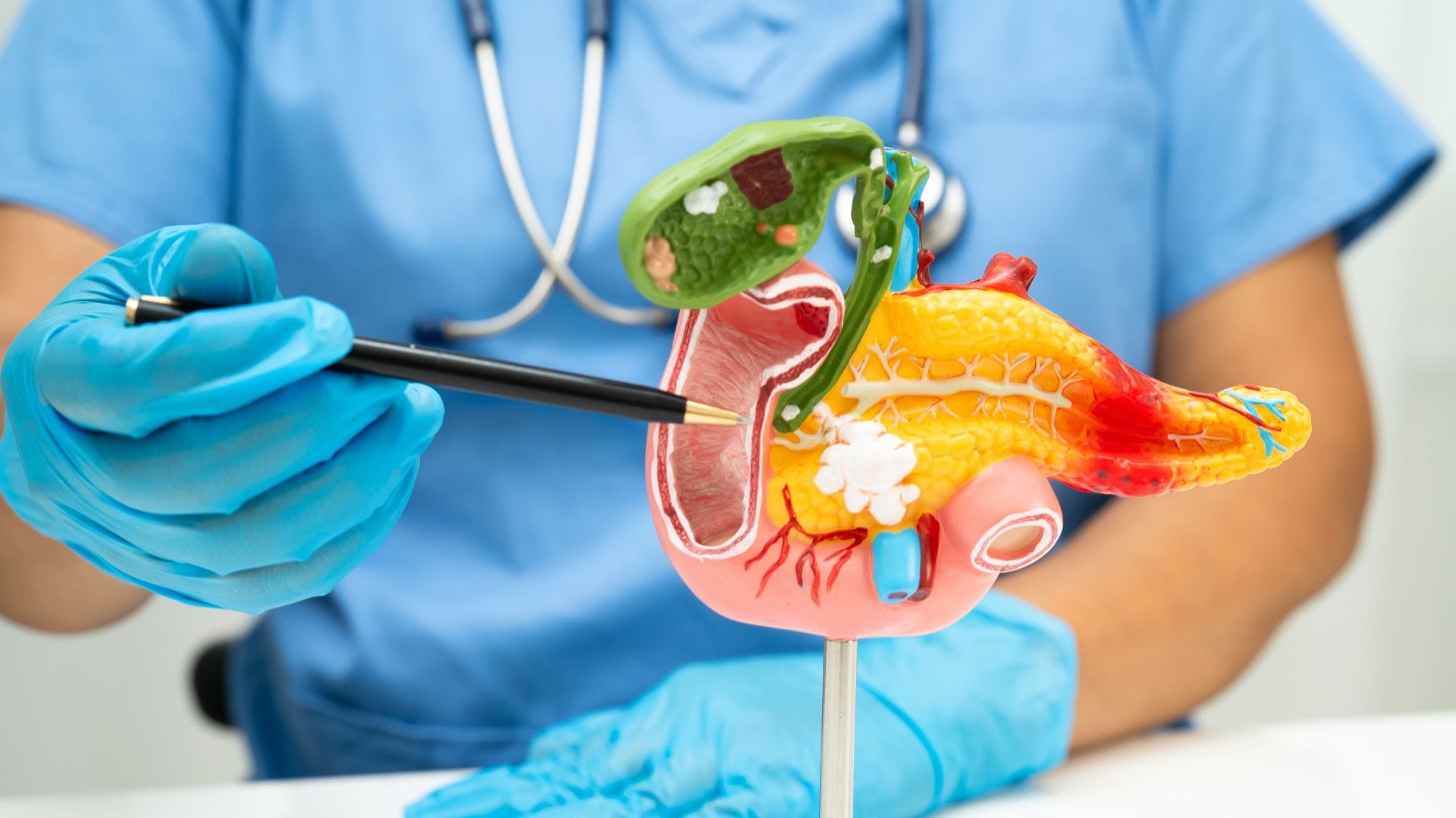 Health Tips Daily Mistakes Increase Gallbladder Stone Risk Know Major Causes Of Gallstones