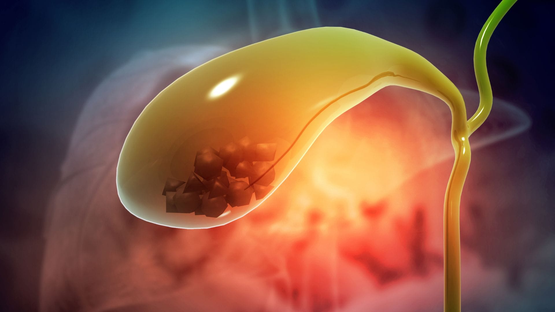 Health Tips Daily Mistakes Increase Gallbladder Stone Risk Know Major Causes Of Gallstones