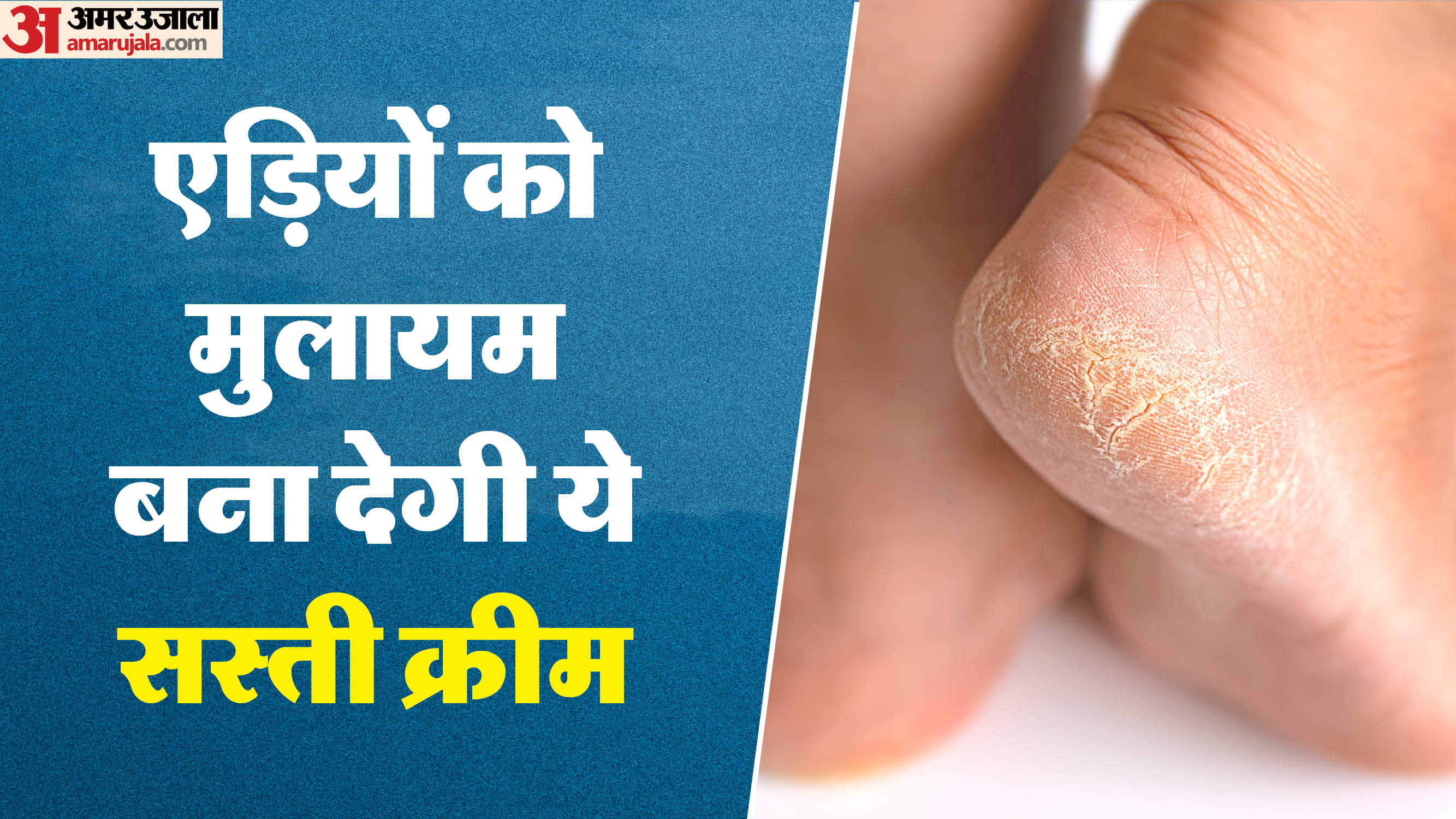 Foot Creams for Winter Repair Cracked Heels in Just 15 Days With This Effective Formula