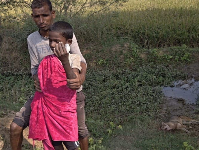 सियार के हमले में घायल किशोर।