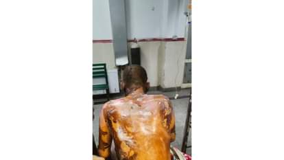 Dry fruit seller sets himself on fire after police questioning