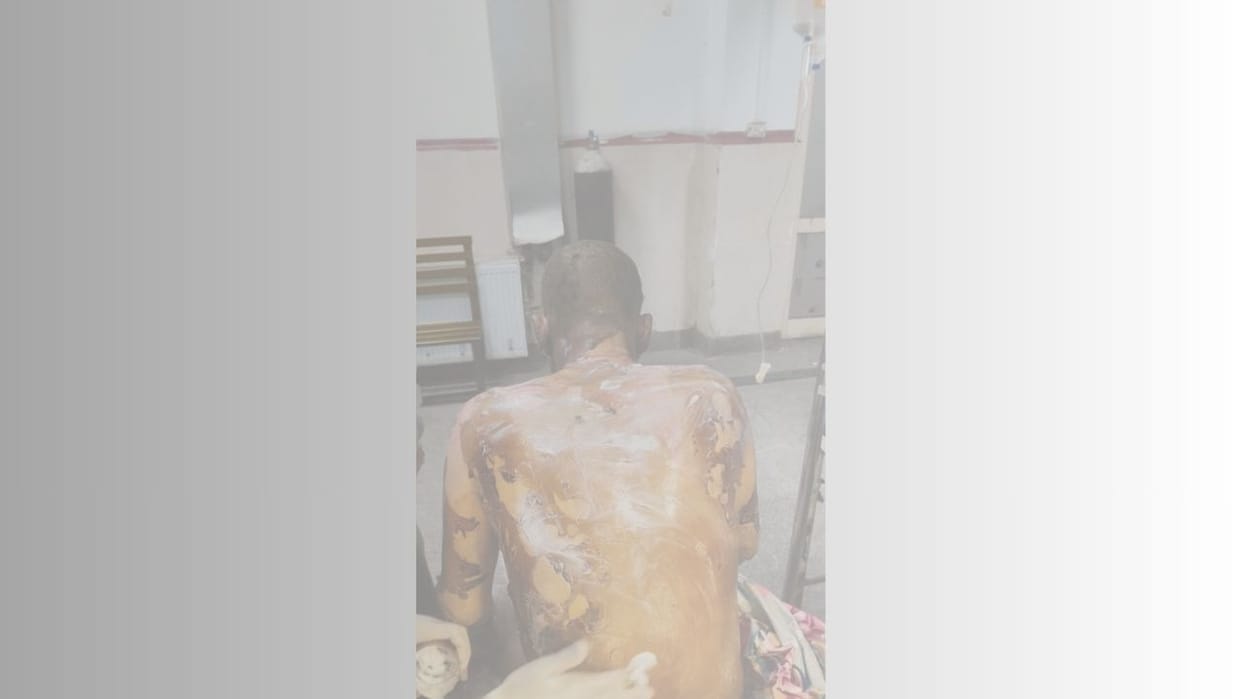 Dry fruit seller sets himself on fire after police questioning
