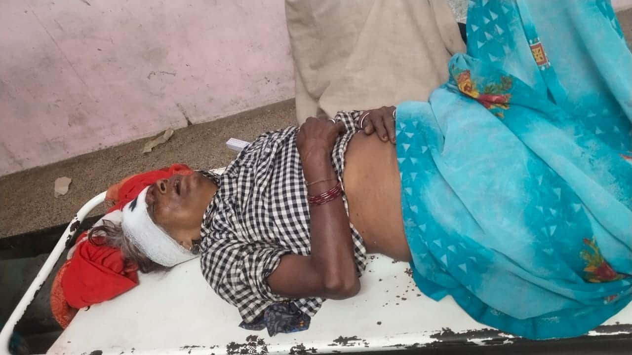 Two buses collided head-on on Ranjit Nagar bridge in Lakhimpur Kheri a Nepali woman dided and 35 injured