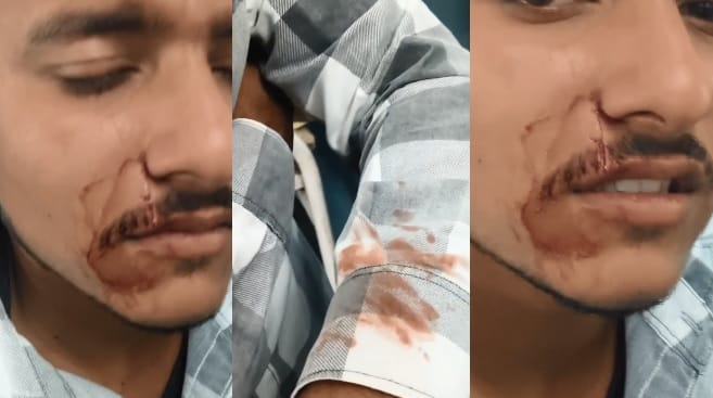 Kanpur student returning from college was attacked with  knife 14 15 attackers were riding on six bikes