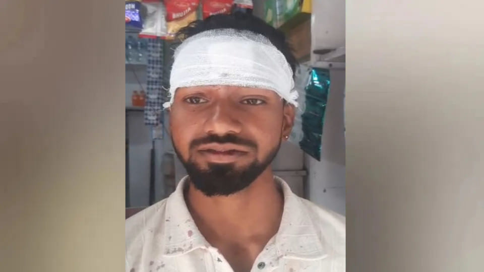 In Deoria, miscreants attacked a youth, head fractured, injured - case registered.