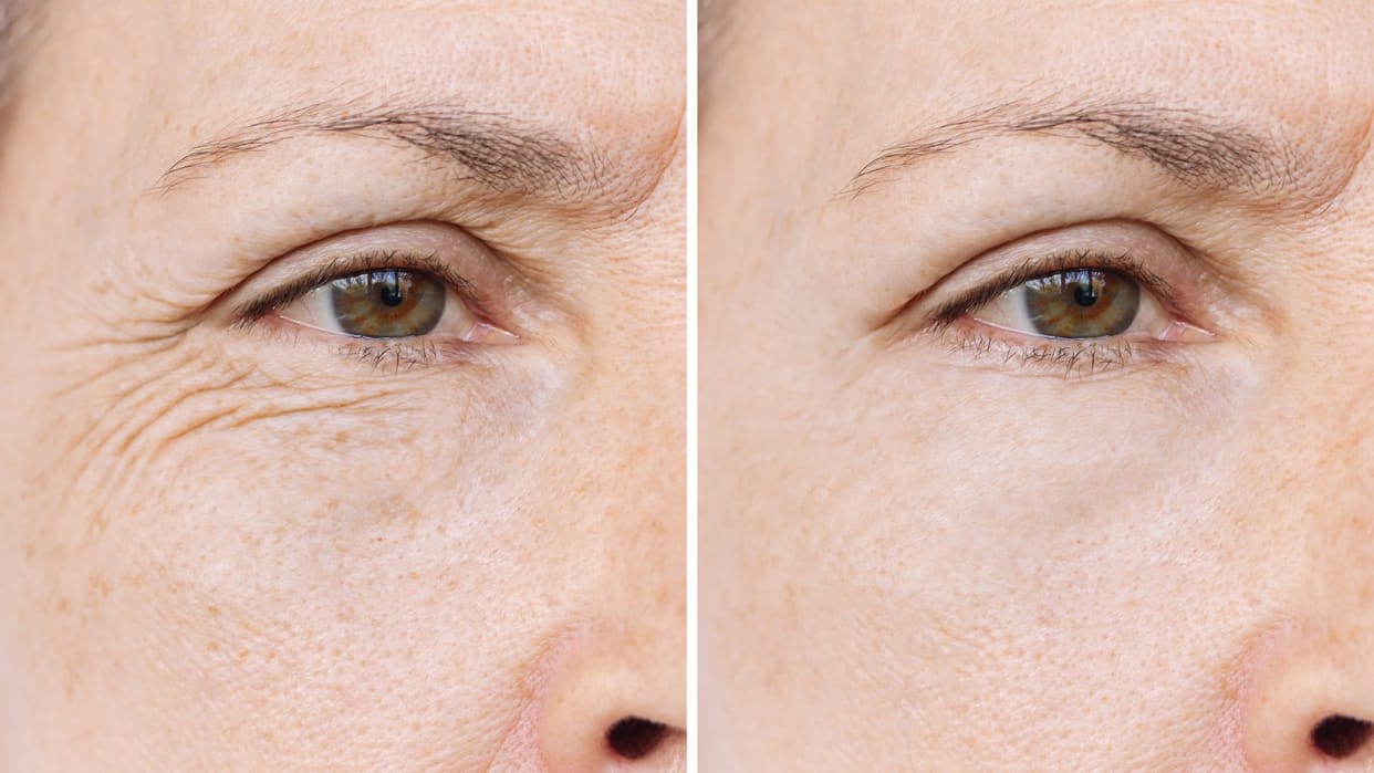 how to remove wrinkle from skin in hindi chehre ki jhuriyan kaise hataye gharelu upay