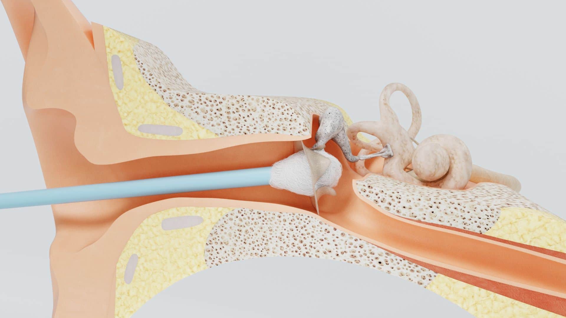 Ear Health Care Tips: What to Do If Water Enters Your Ear While Bathing