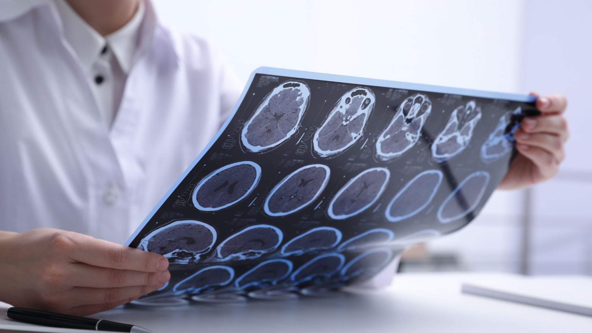 Epilepsy What to Do When Seizures Hit Common Mistakes That Can Be Dangerous