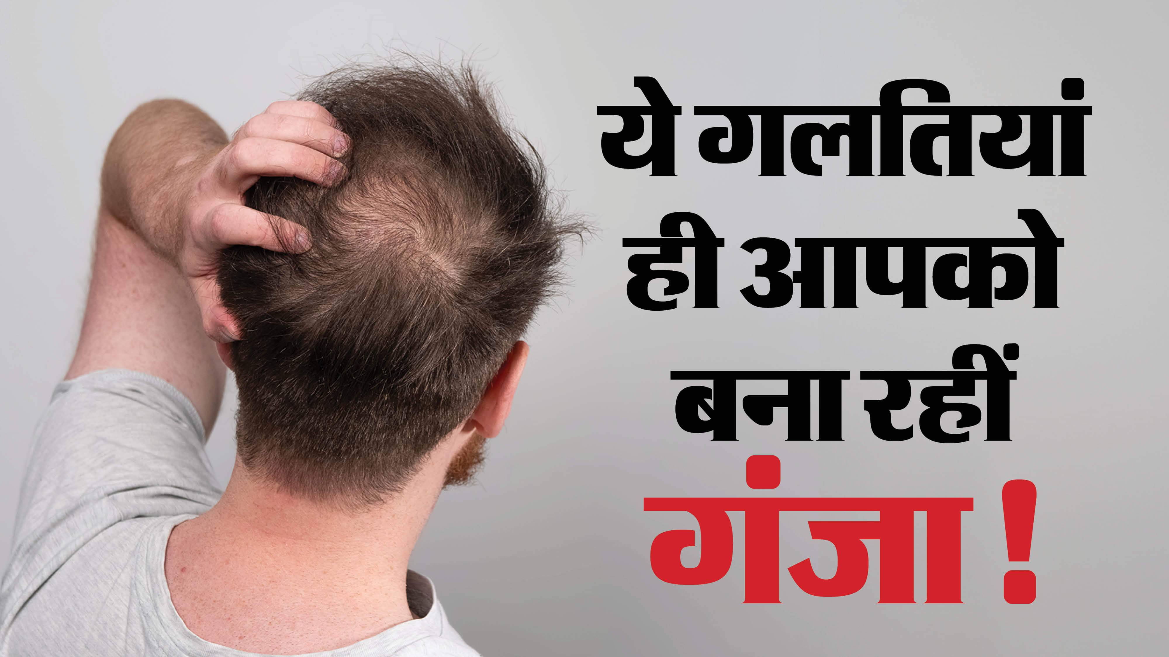 Hair Care Tips in Hindi  Mistakes To Prevent Hair Fall Baldness Causes  Men