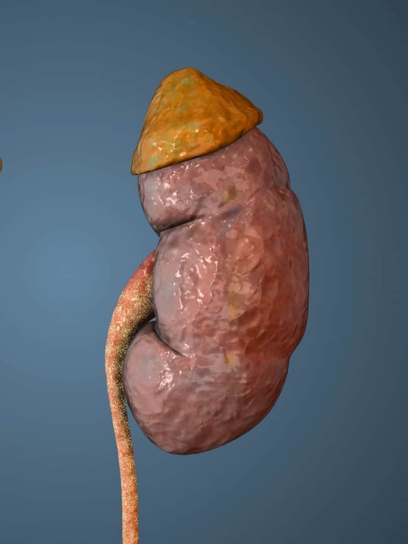 किडनी फेलियर