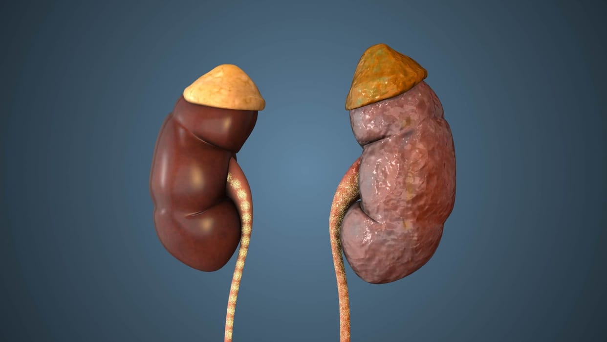 Kidney Detox Tips: Natural Foods and Diet Changes to Cleanse Your Kidneys Fast
