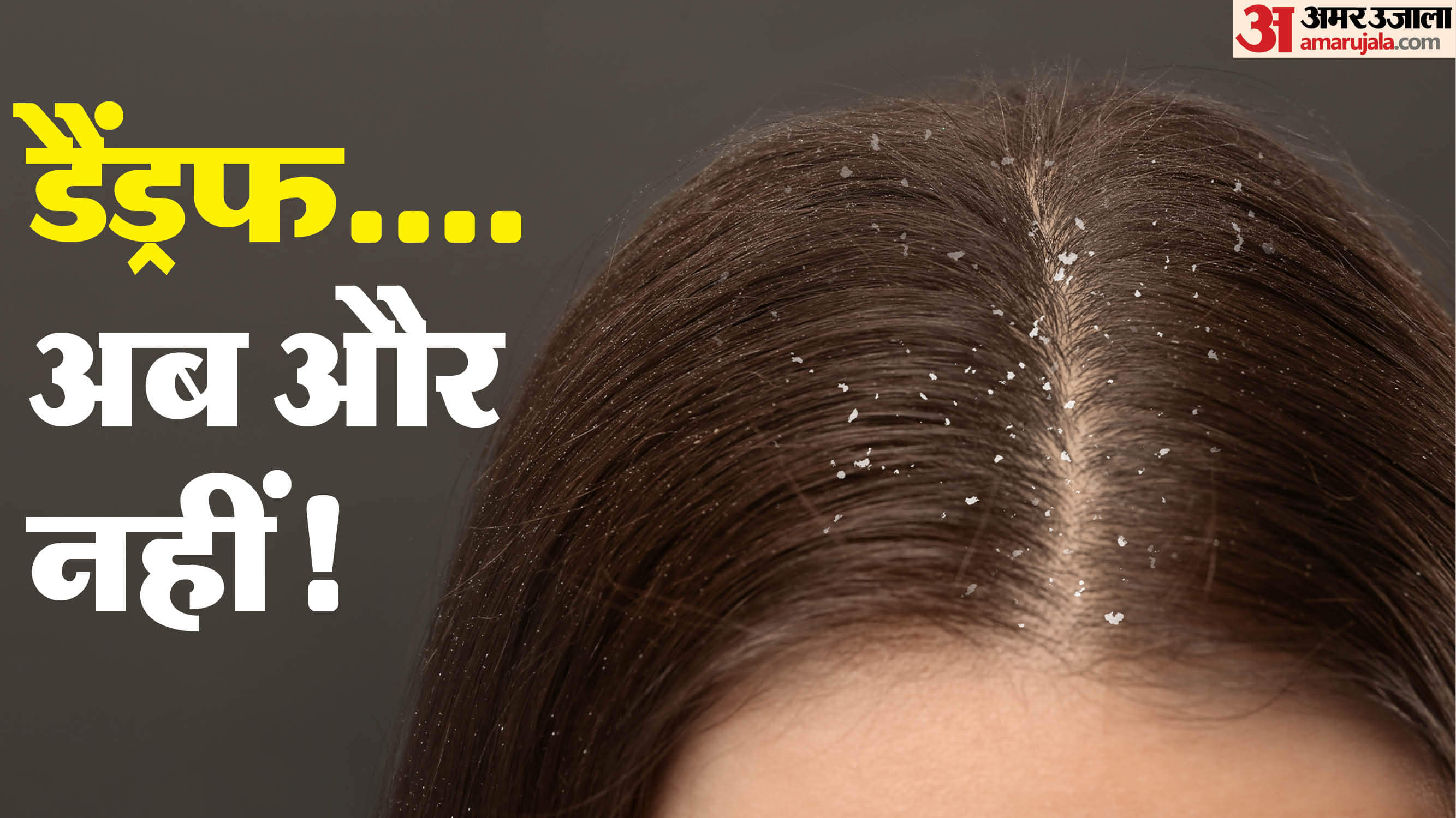 Hair Care Tips Dandruff Falling Like Powder Check Effective Home Remedies