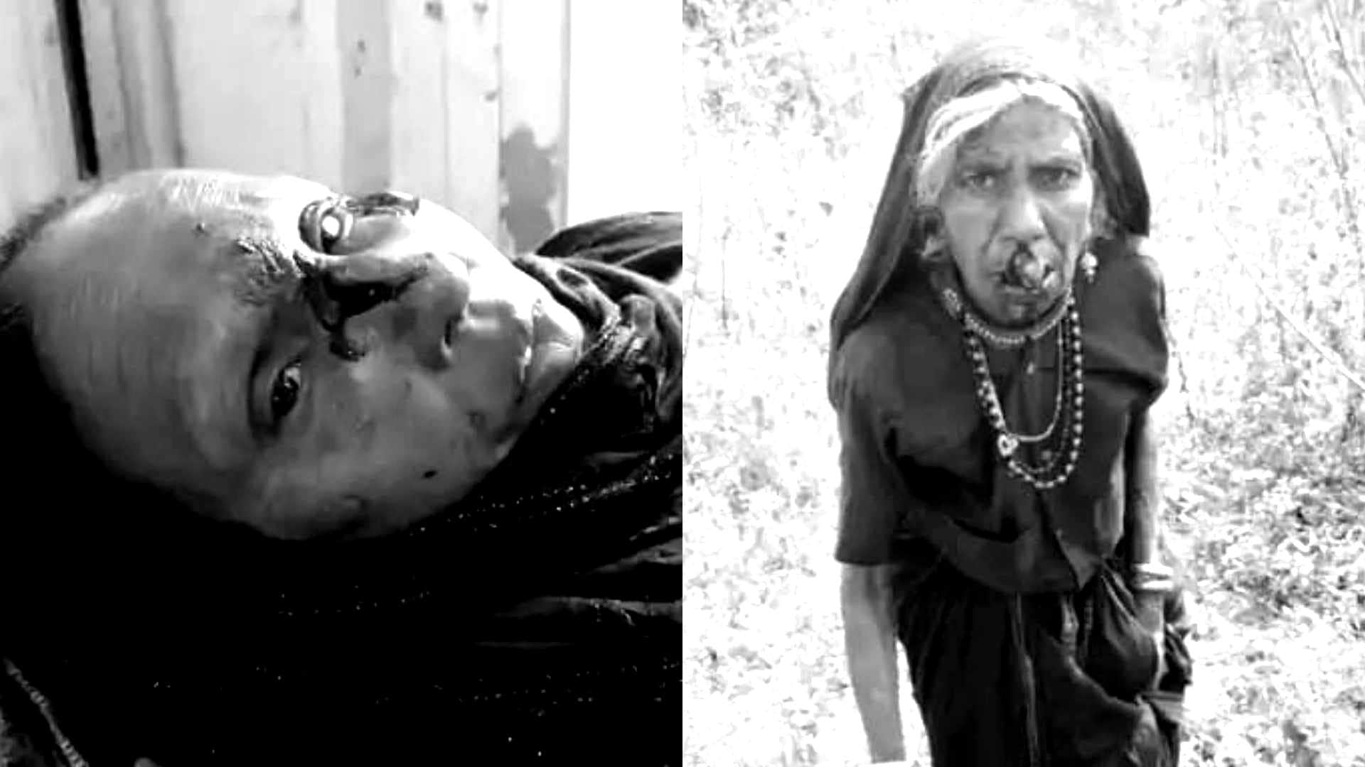 कुत्ते के हमले में घायल महिलाएं।