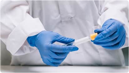 UP: Pain relievers are in distress, caught between the AYUSH and Medical and Health departments.