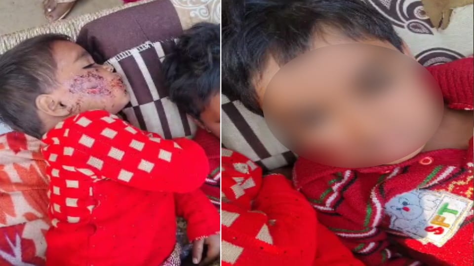 Meerut: Stray Dog Attack in Aurangabad, Three Children Injured While Playing Outside Home