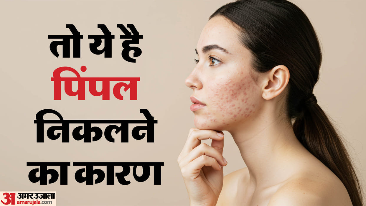 Does Fried Food Cause Pimples Know Myth and Facts