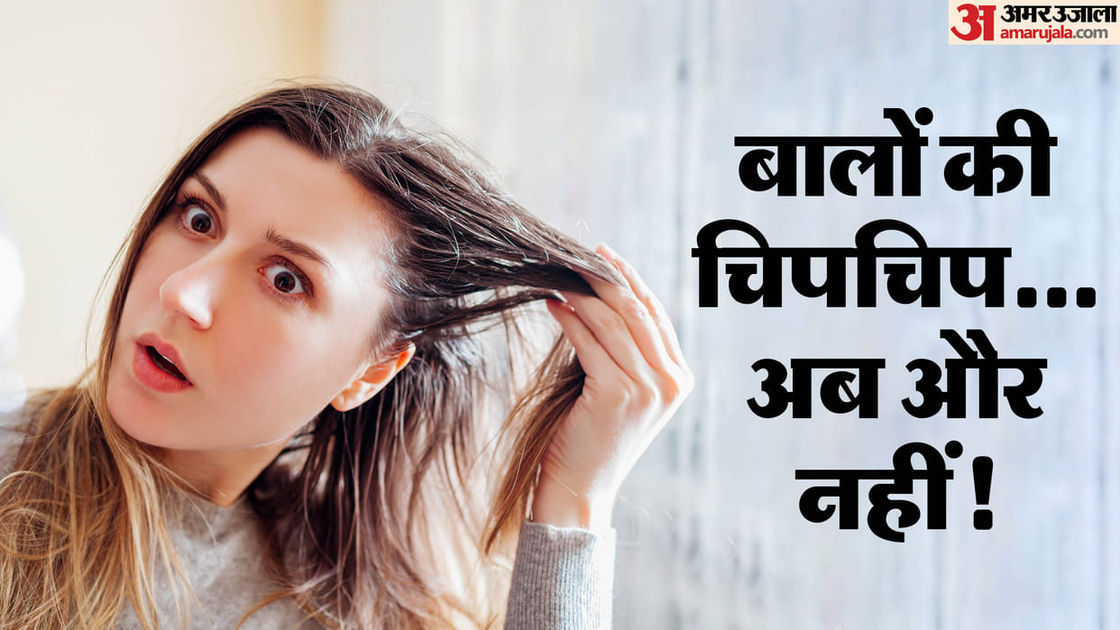 Oily Hair Remedy Check Simple tips and home remedies to get rid of Greasy Hair