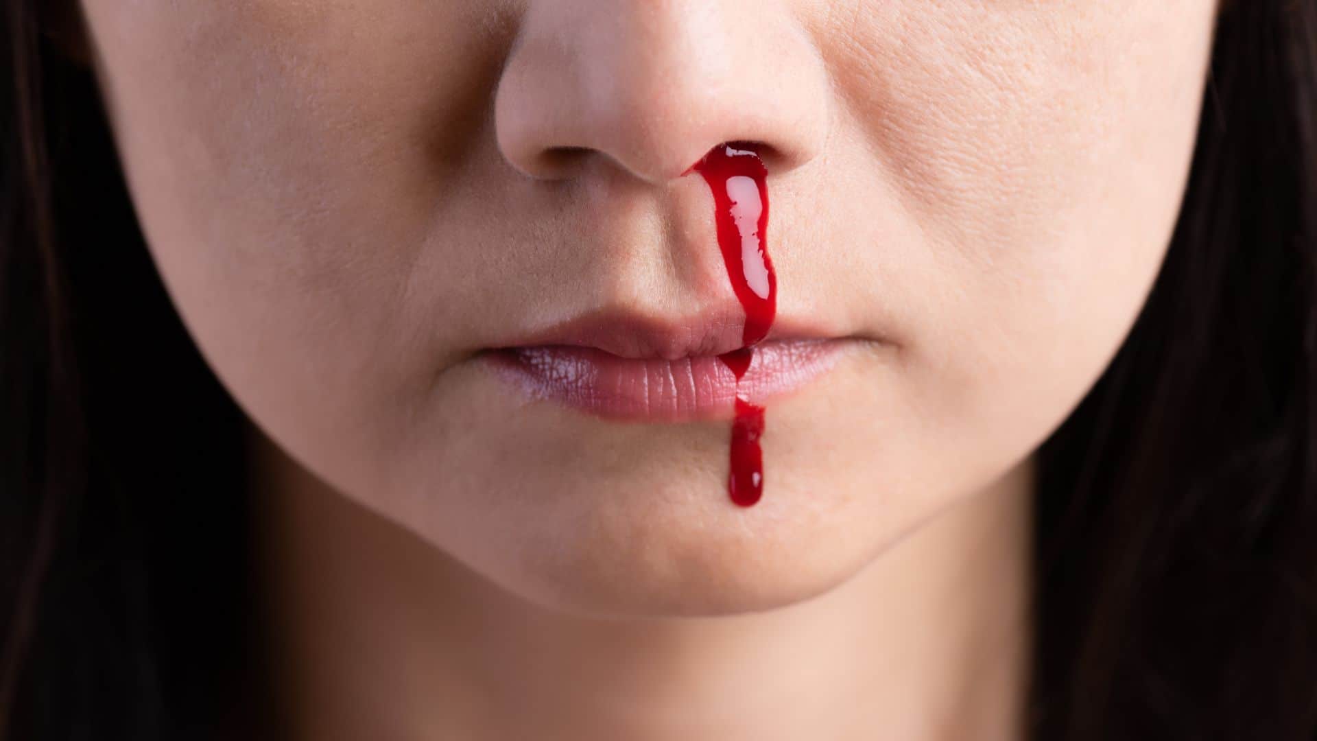 Nose Bleeding While Sneezing Check Causes Symptoms and Prevention Tips in Hindi