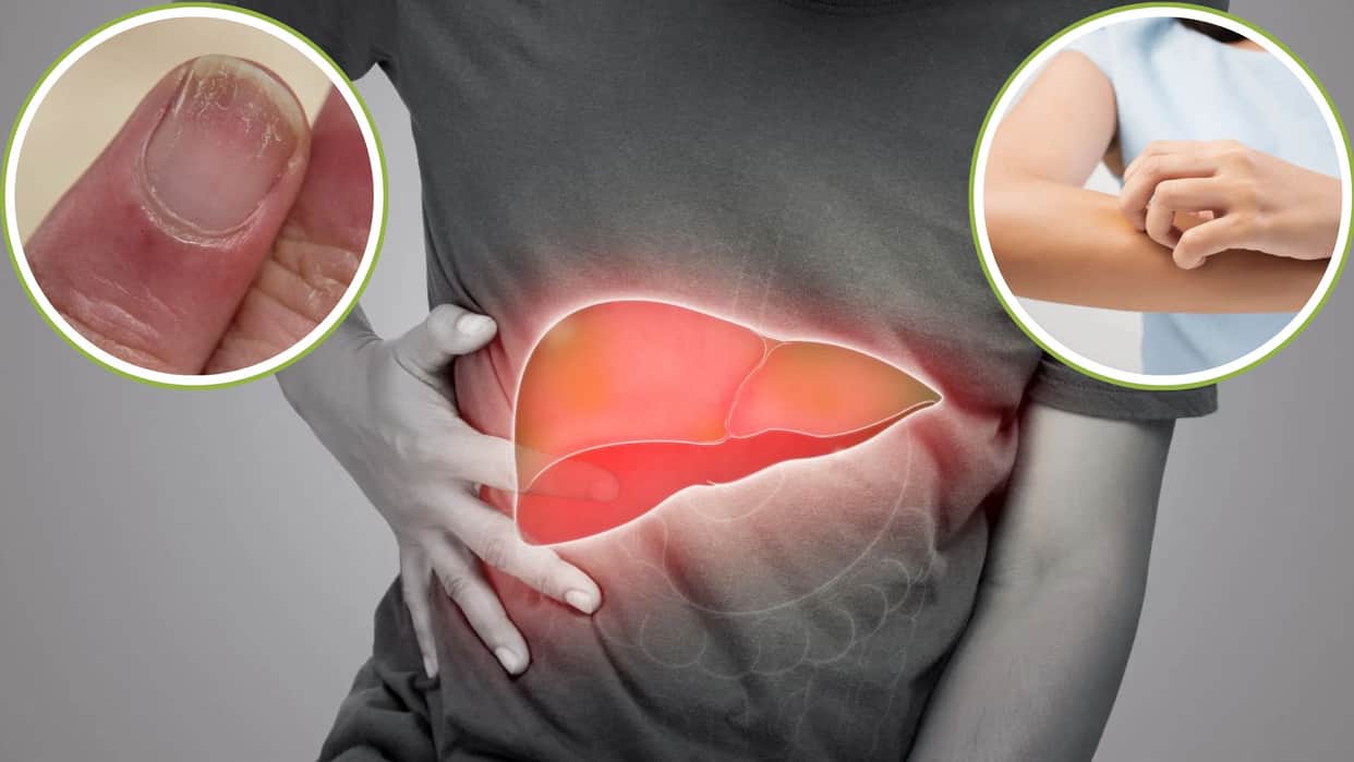 Early signs of Liver Damage You Can See on Your Hands Feet Nails Check symptoms causes treatments